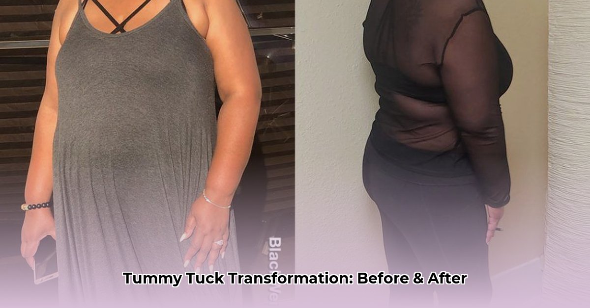 weight-loss-tummy-tuck-before-and-after